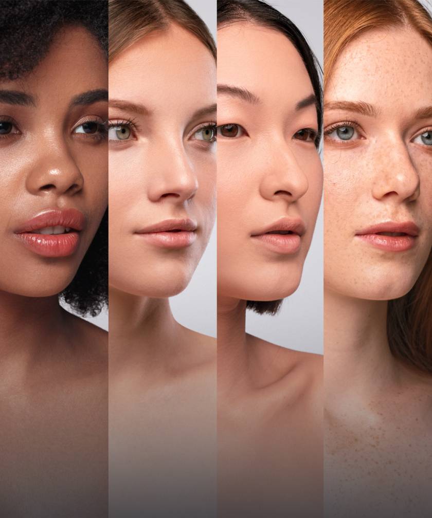 Patients from different ethnic background